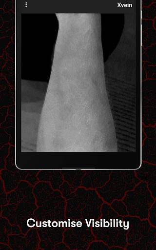 X-Vein screenshot 11