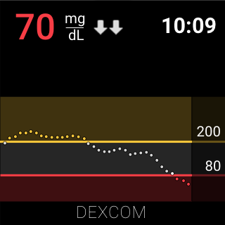 Dexcom G6 screenshot 5