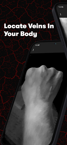 X-Vein screenshot 6