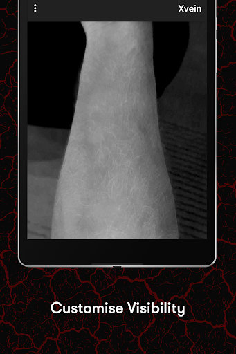 X-Vein screenshot 16