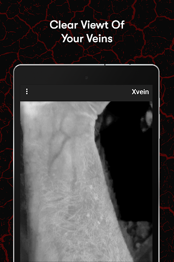X-Vein screenshot 9