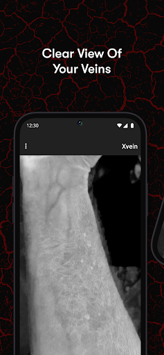 X-Vein screenshot 14
