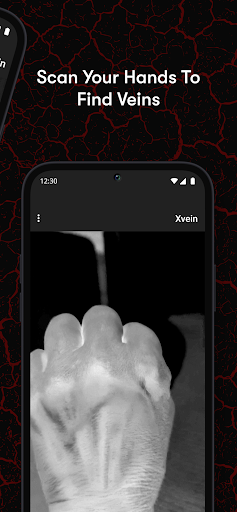 X-Vein screenshot 7
