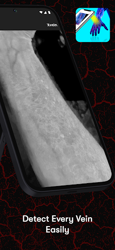 X-Vein screenshot 3