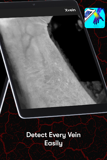 X-Vein screenshot 1