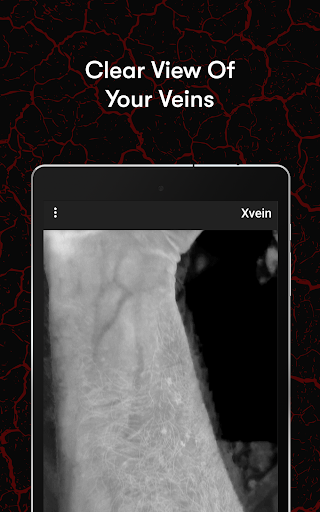X-Vein screenshot 15