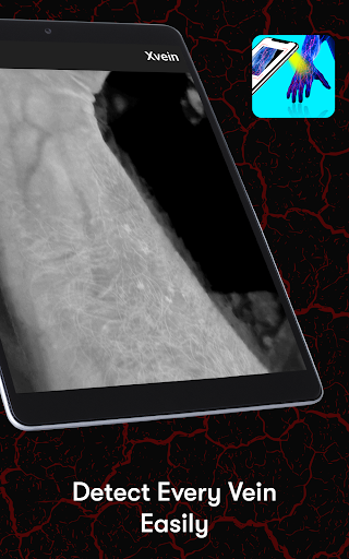 X-Vein screenshot 5
