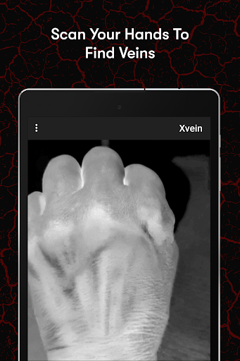 X-Vein screenshot 13