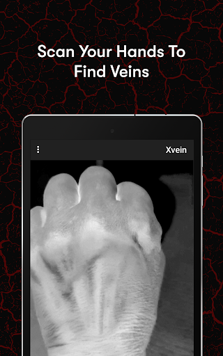 X-Vein screenshot 2