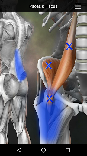 Muscle Trigger Point Anatomy screenshot 21