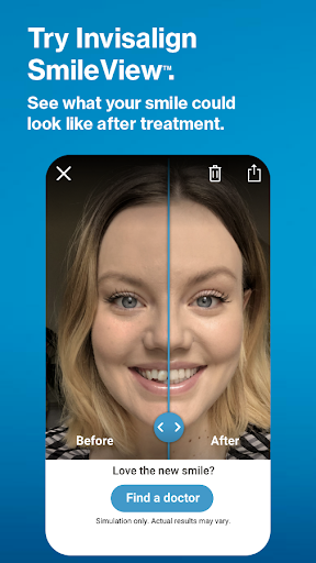 My Invisalign - Official App screenshot 5