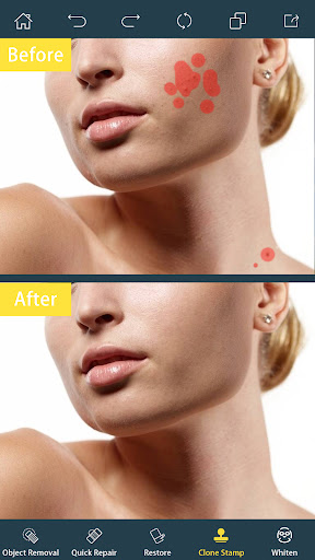 Photo Retouch- Object Removal screenshot 5