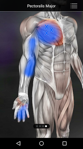 Muscle Trigger Point Anatomy screenshot 17