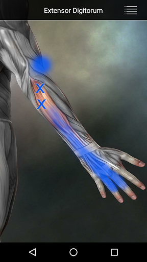 Muscle Trigger Point Anatomy screenshot 10